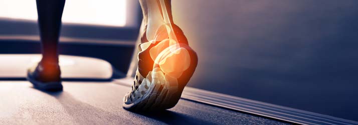 Podiatry Matawan NJ Achilles Tendonitis